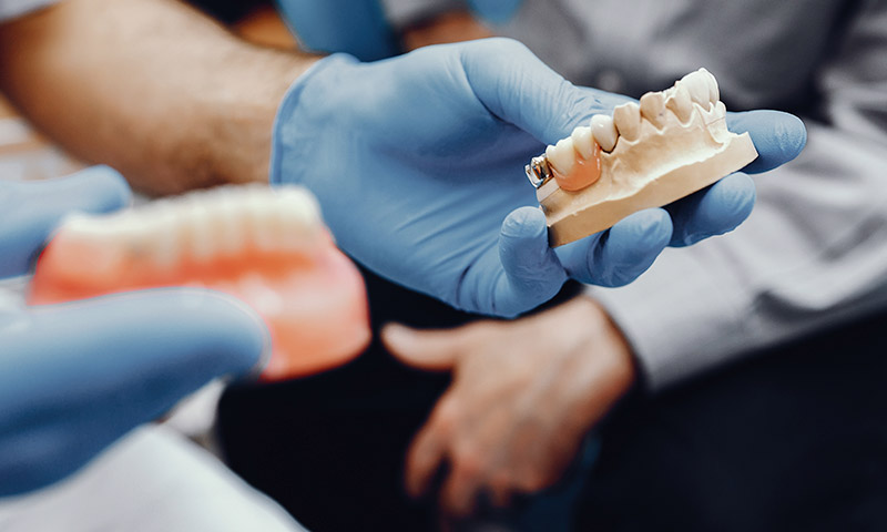 El proceso de trabajo de un laboratorio de prótesis dentales