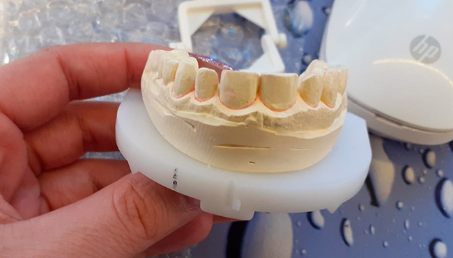 modelos previo carillas de emax unistar laboratorio dental